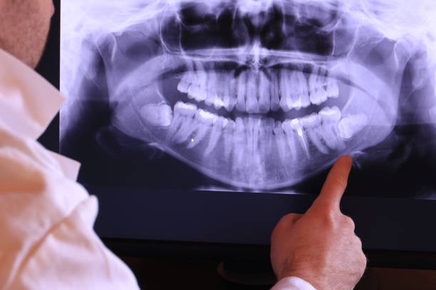 Best Dentist for Tooth Abscess  in Kittery Point, ME
