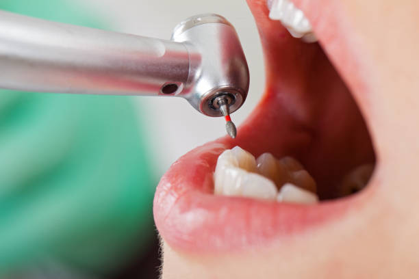Urgent Tooth Repair in ME